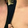 Light Up Your Face with Lumecca IPL- - Image 2
