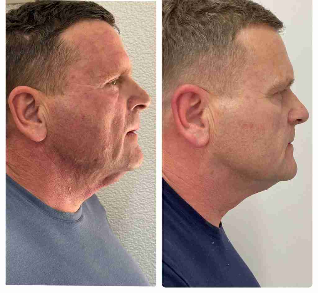 Male Facial Aesthetics — original clinic imagery