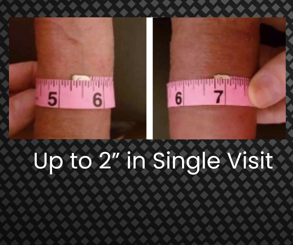 Girth Enhancement — original clinic imagery